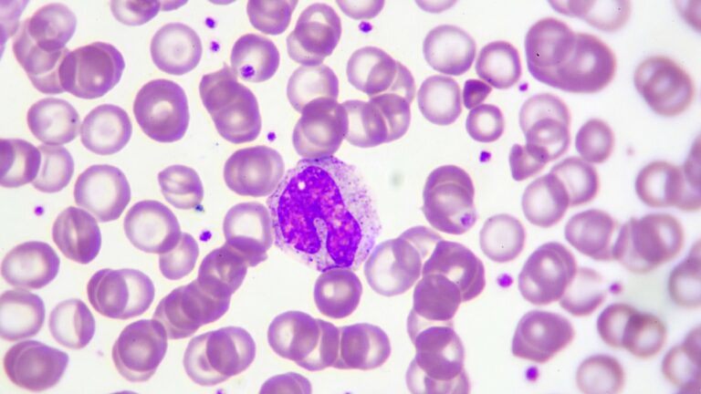 monocytes eleves
