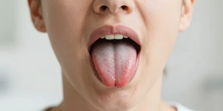 Langue vague sur les côtés : les causes et les traitements naturels